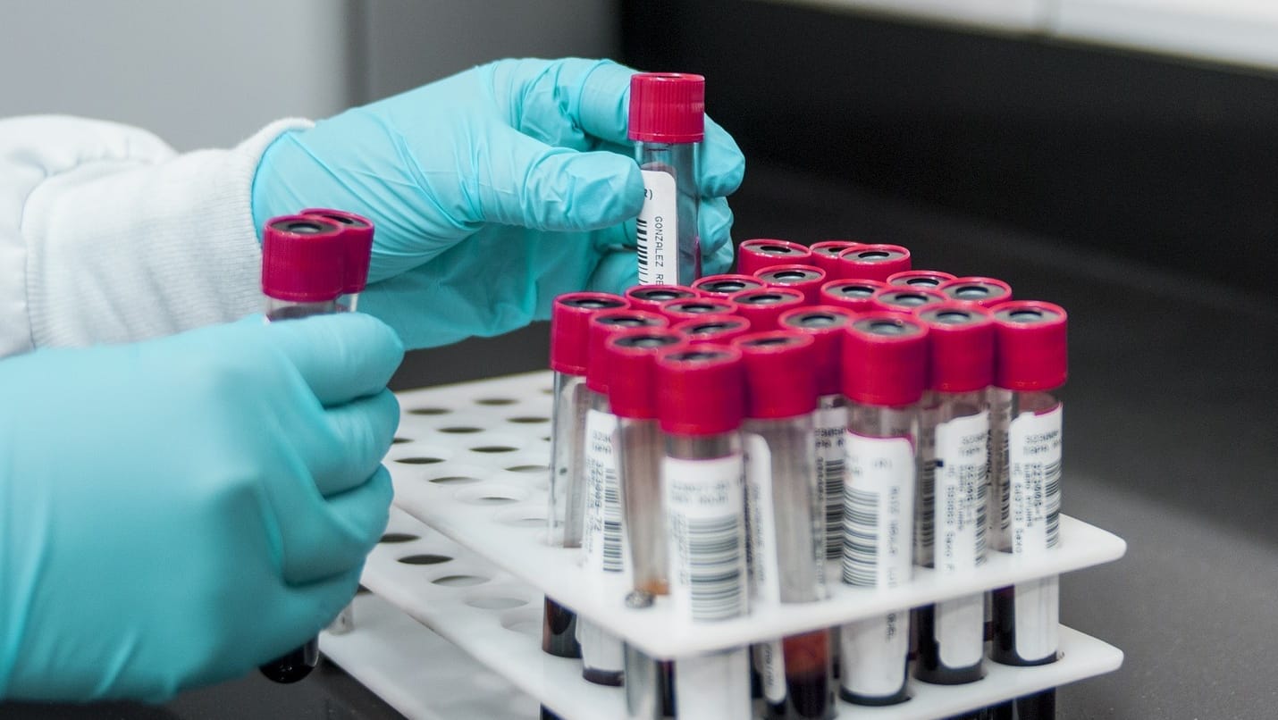 Шведская и французская лаборатория, а также эксперты ОЗХО сами брали у Навального пробы, в которых нашли «Новичок»