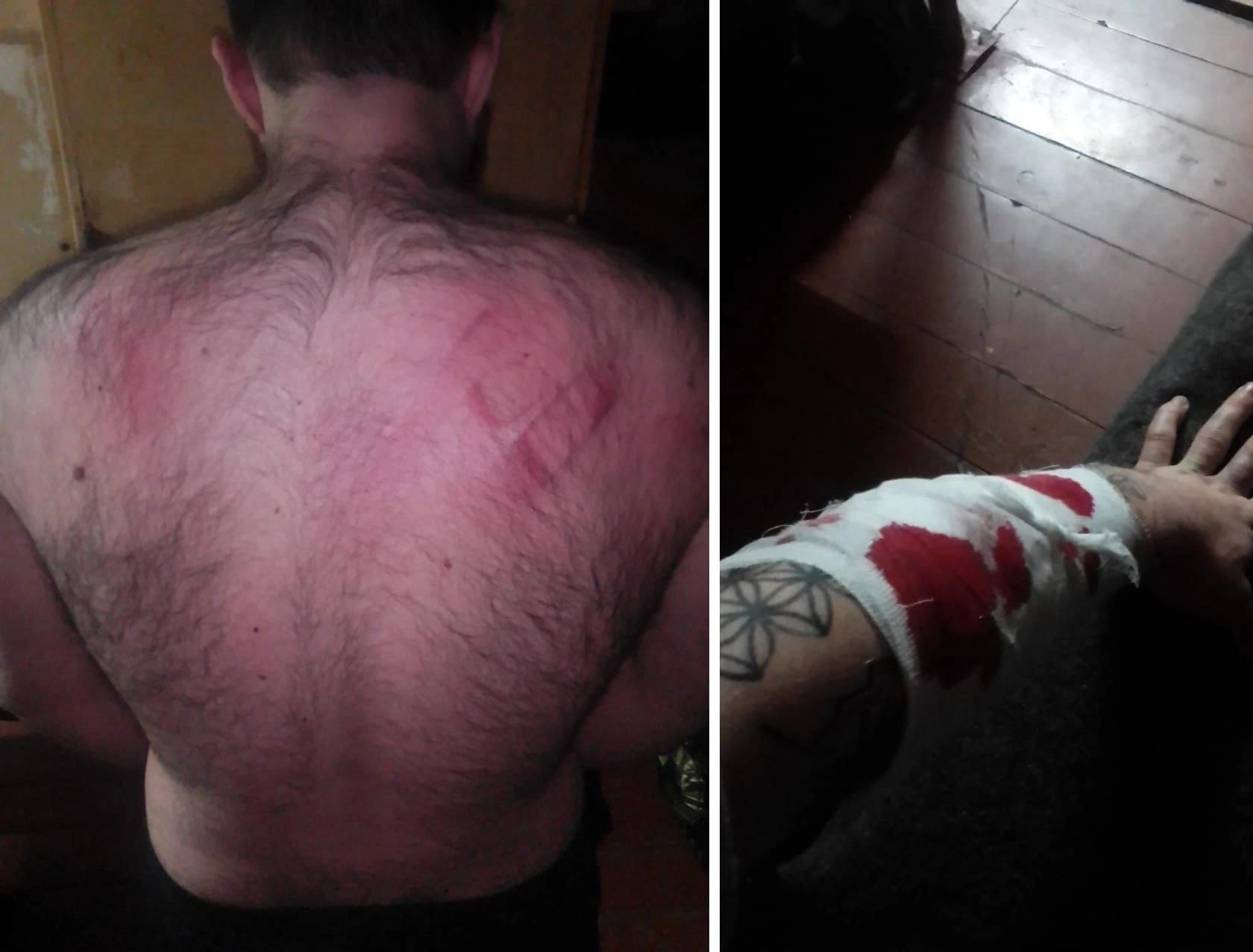 «Ставят в растяжки, избивают, угрожают изнасилованием». На заключенных ульяновских колоний, сообщивших о пытках, заводят уголовные дела